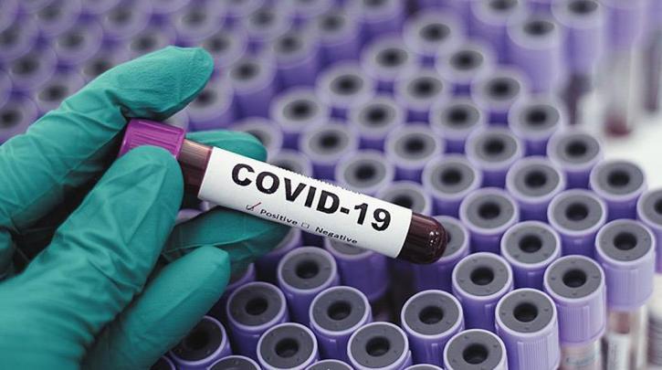 Πρώτη στον κόσμο η Ελλάδα σε κρούσματα COVID-19 την τελευταία εβδομάδα