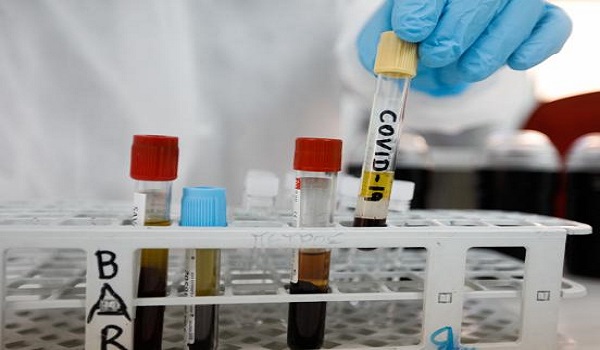 Κορονοϊός: Έμεινε στάσιμη η έρευνα για τον καρκίνο λόγω της πανδημίας