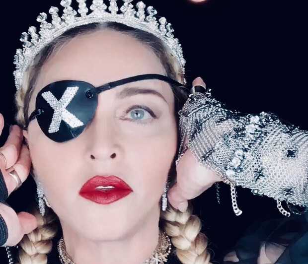 Σκάνδαλο: Η τραγική προσπάθεια της Madonna να ξεγελάσει το κοινό της Eurovision