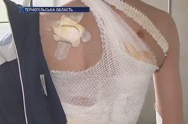 Έκλαιγαν τον νεκρό στο σπίτι και έβαλαν κατά λάθος φωτιά στο φέρετρο. Στο νοσοκομείο 10χρονος