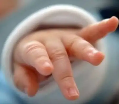 Μάχη για τη ζωή του δίνει βρέφος 30 ημερών: Διασωληνωμένο στη ΜΕΘ με τον ιό RSV