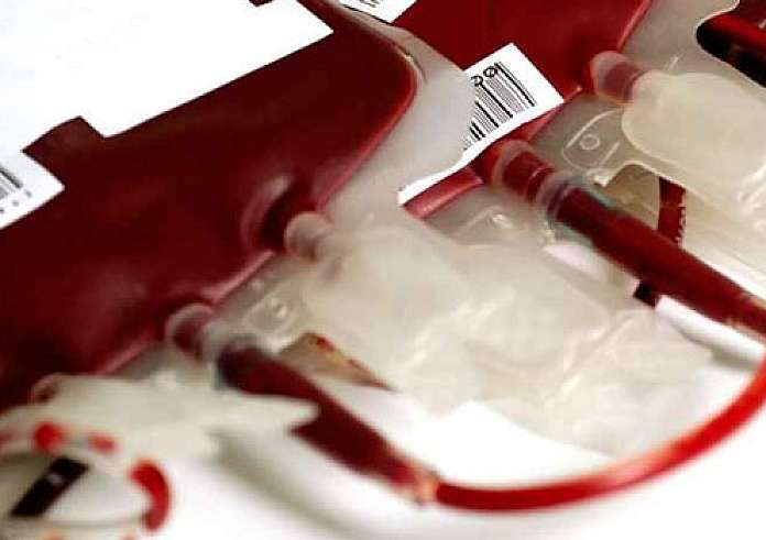 Μεγάλη Βρετανία: Επί 20 χρόνια διέθεταν μολυσμένο αίμα σε ασθενείς – Περισσότεροι από 3.000 θάνατοι
