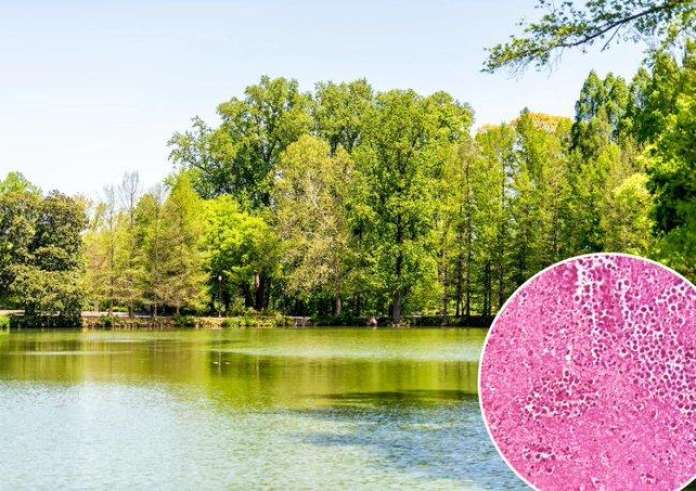 Νεκρός κολυμβητής από σπάνια αμοιβάδα που τρώει τον εγκέφαλο - Τι είναι και τι προκαλεί