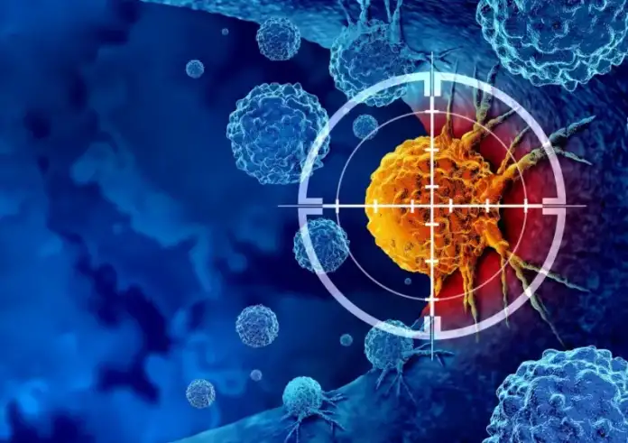 Το πρώιμο σημάδι του καρκίνου που οι περισσότεροι αγνοούν