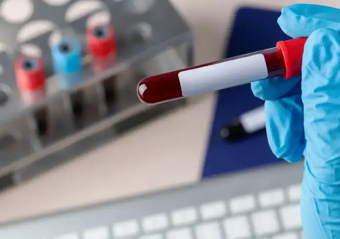 Καρκίνος: Η ομάδα αίματός σας μπορεί να αποκαλύψει εάν διατρέχετε υψηλότερο κίνδυνο