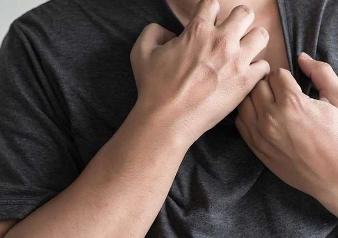 Ποιοι τύποι καρκίνου προκαλούν φαγούρα στο δέρμα