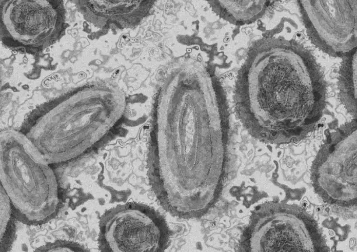 Πρόεδρος ΕΟΔΥ για mpox: «Περιμένουμε περισσότερα εισαγόμενα κρούσματα» – Τι εκτιμά για την έξαρση του στρεπτόκοκκου