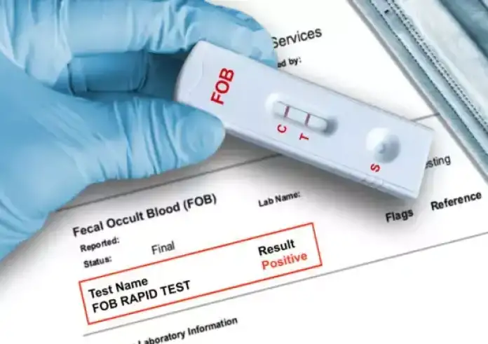 Καρκίνος Παχέος Εντέρου: Δωράν διάγνωση με self test από τα Φαρμακεία για 2,8 εκατομμύρια Έλληνες