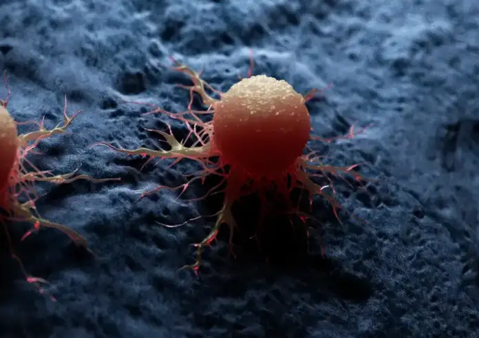 Διαγνώστηκε με καρκίνο στα 33 της μοιράζεται τα 2 συμπτώματα που αγνόησε