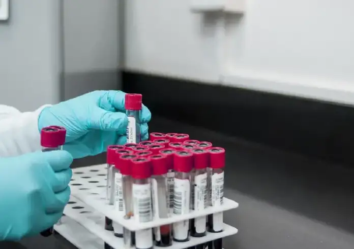 Ευλογιά των Πιθήκων: Ο ΠΟΥ ενεργοποιεί το υψηλότερο επίπεδο συναγερμού για τον ιό – Ποια είναι τα συμπτώματα