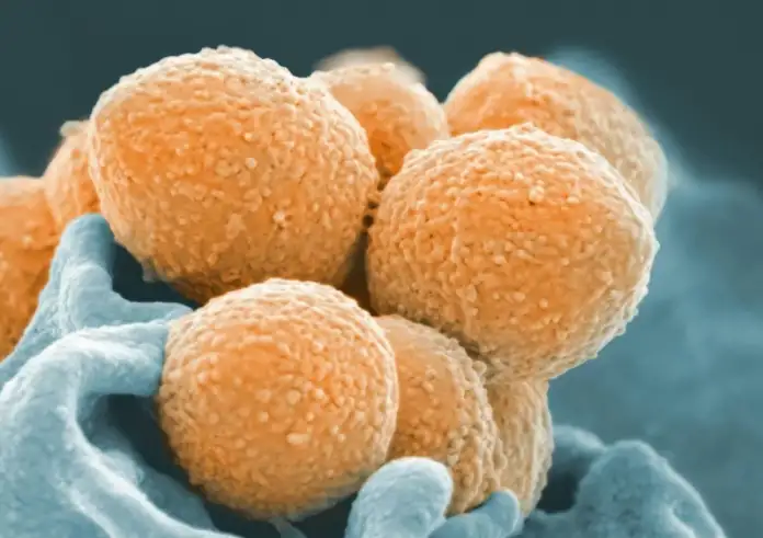 Στρεπτόκοκκος: Καλή η κατάσταση δύο ασθενών που νόσησαν στην Ηλεία – 48 κρούσματα και 12 θάνατοι από την αρχή του έτους