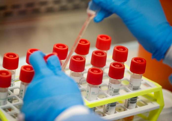 Προλαμβάνω: Ποιες 3 νέες δωρεάν εξετάσεις θα κάνουμε μέσω του προγράμματος