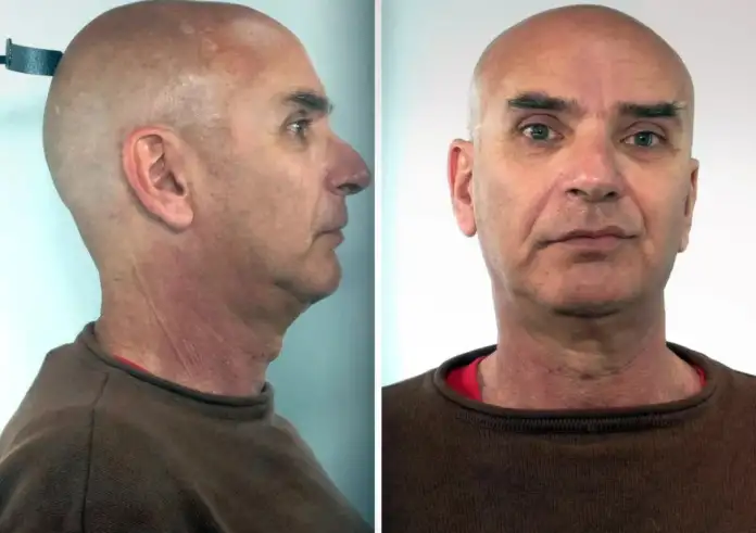 Εργοθεραπευτής κατηγορείται για ασέλγεια σε ανήλικα - Η ΕΛ.ΑΣ. δημοσίευσε τα στοιχεία του