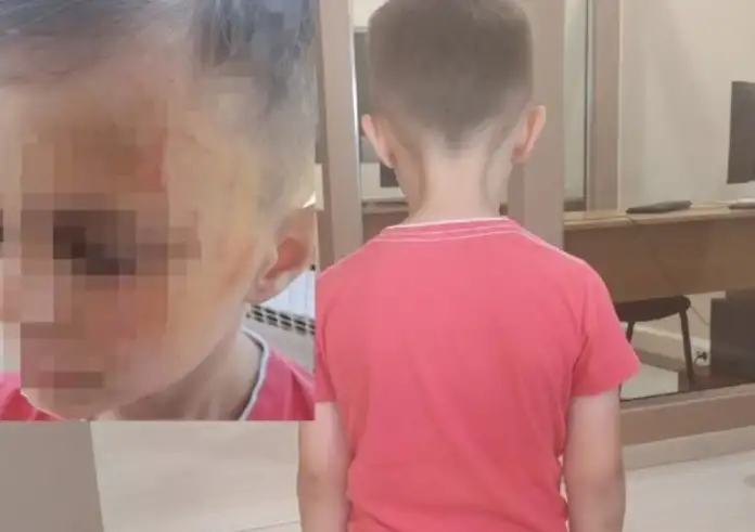 Αγρίνιο: Μαθητές νηπιαγωγείου ξυλοκόπησαν άγρια 5χρονο παιδί