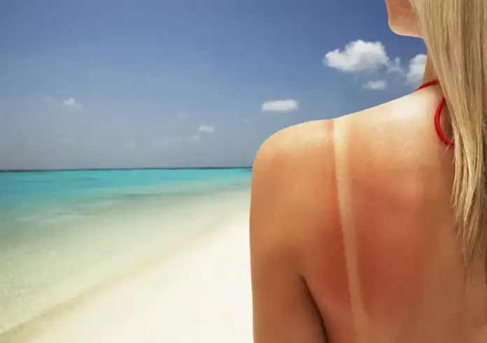 Πόσα λεπτά πρέπει να καθόμαστε στον ήλιο για ασφαλές μαύρισμα – Τι εξαρτάται από τον τύπο επιδερμίδας σου