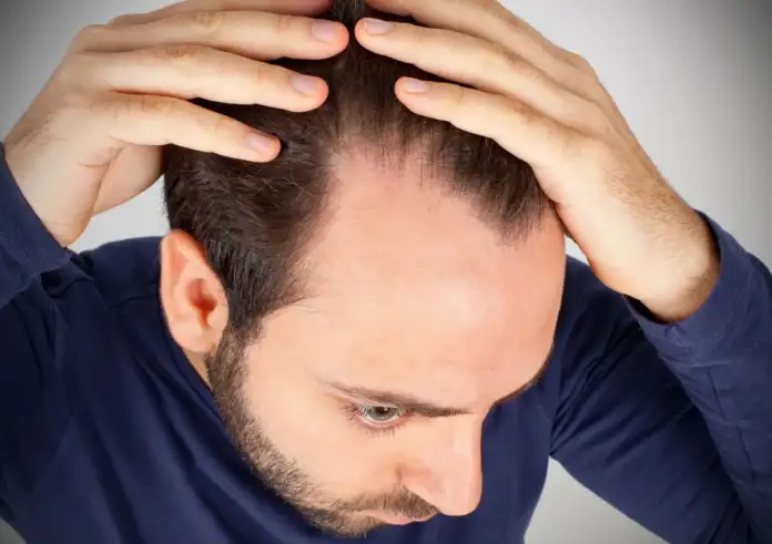 Ελπίδα για την τριχόπτωση: Νέος ορός από φυσικά λιπαρά οξέα αναγεννά τα μαλλιά