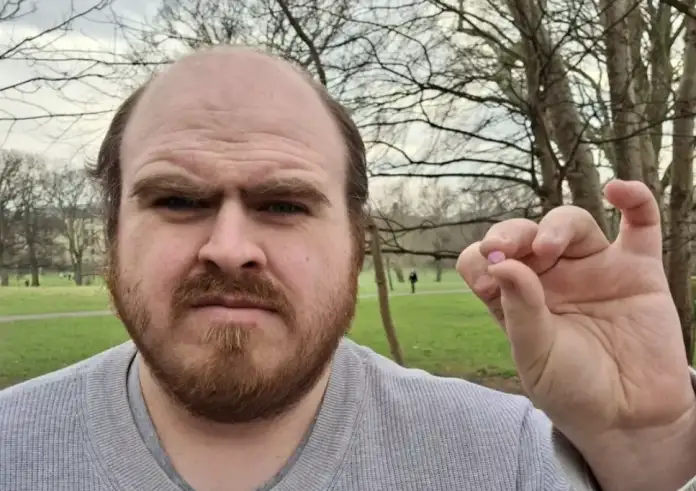 Άκουγε λιγότερο για 20 χρόνια – Μέχρι που βρήκε στο αυτί του ένα… τουβλάκι Lego