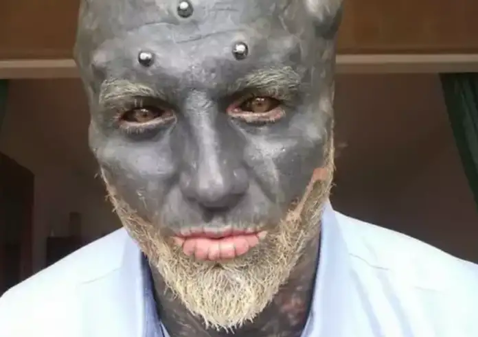 Anthony Loffredo: Ο άνδρας που έχει φτάσει στο 71% της «μεταμόρφωσης σε μαύρο εξωγήινο» – Το σοκαριστικό project