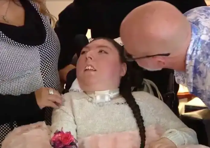 «Θαύμα ζωής»: Γυναίκα από τη Νεμπράσκα γεννήθηκε χωρίς εγκέφαλο και γιόρτασε τα 20ά της γενέθλια