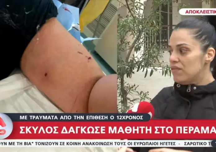 Σοβαρός τραυματισμός 12χρονου στο Πέραμα από επίθεση σκύλου – Στο Παίδων με πολλαπλές δαγκωματιές