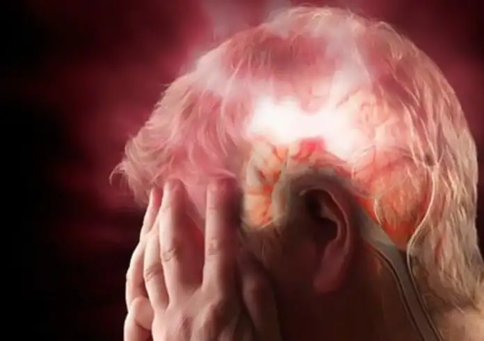 Εγκεφαλικό επεισόδιο: Το ασυνήθιστο σύμπτωμα που δεν πρέπει να αγνοήσετε