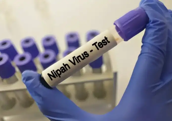 ΠΟΥ: Χαμηλός ο κίνδυνος παγκόσμιας εξάπλωσης για τον ιό Νίπα