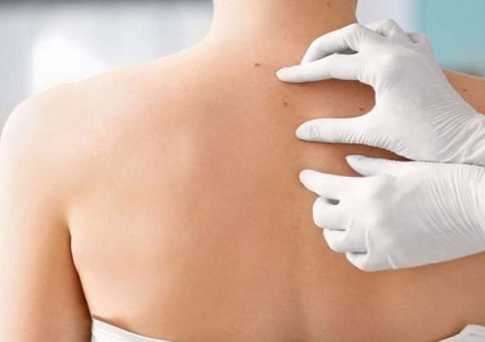 Τι είναι οι κόκκινες κουκκίδες στο δέρμα: Τι να προσέξετε