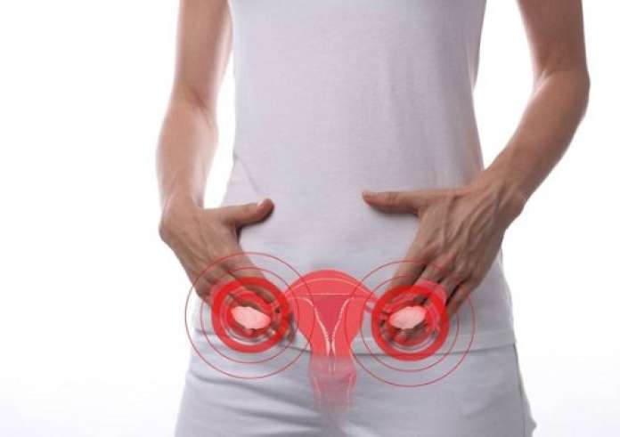 Σύνδρομο πολυκυστικών ωοθηκών: Τα κρυφά σημάδια της πάθησης που οι περισσότεροι αγνοούν