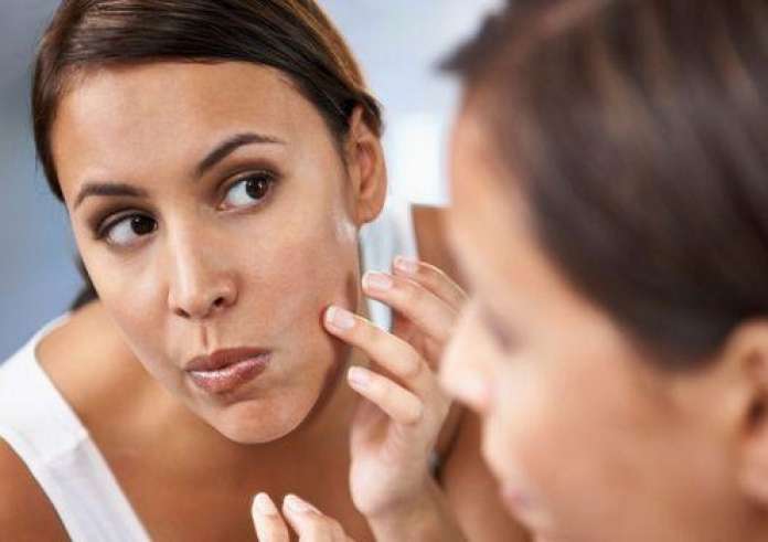 Aκμή στο σώμα: Πώς να την αντιμετωπίσεις τους θερινούς μήνες