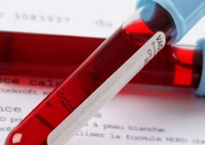 Εξετάσεις που πρέπει να κάνουμε μετά τα 40, 50, 60