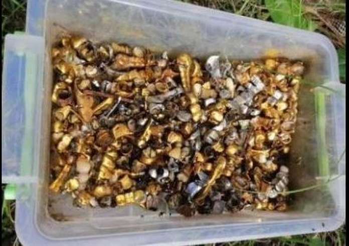 Αφαίρεσαν 526 δόντια από το στόμα 7χρονου