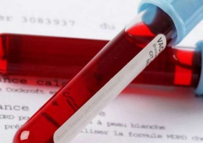 Από 1η Απριλίου θα χρεώνονται τα παραπεμπτικά για εξετάσεις στον ιδιωτικό τομέα, ανακοίνωσε ο Θεμιστοκλέους