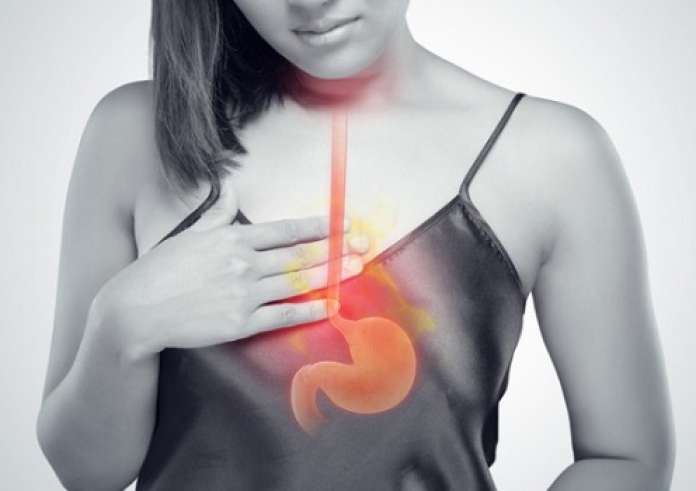 Τέσσερις τροφές που πρέπει να αποφεύγετε, εάν έχετε γαστροοισοφαγική παλινδρόμηση