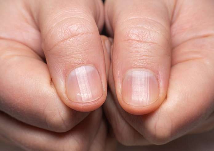 ΕΟΦ: Ανακαλούνται 3 βερνίκια νυχιών