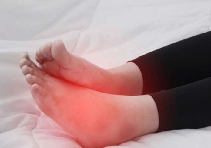Πρησμένα πόδια από τη ζέστη: Πότε το οίδημα κρύβει κινδύνους για την υγεία σας
