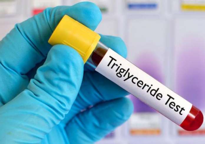 Ανεβασμένα τριγλυκερίδια: Οι τροφές που πρέπει να αποφεύγετε