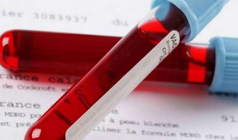 Tεστ αίματος προβλέπει πως εξελίσσεται η Πολλαπλή Σκλήρυνση