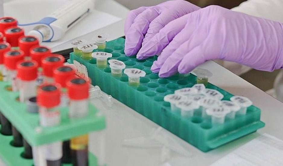 Moderna: Ξεκίνησαν οι δοκιμές σε ανθρώπους του εμβολίου mRNA κατά του HIV
