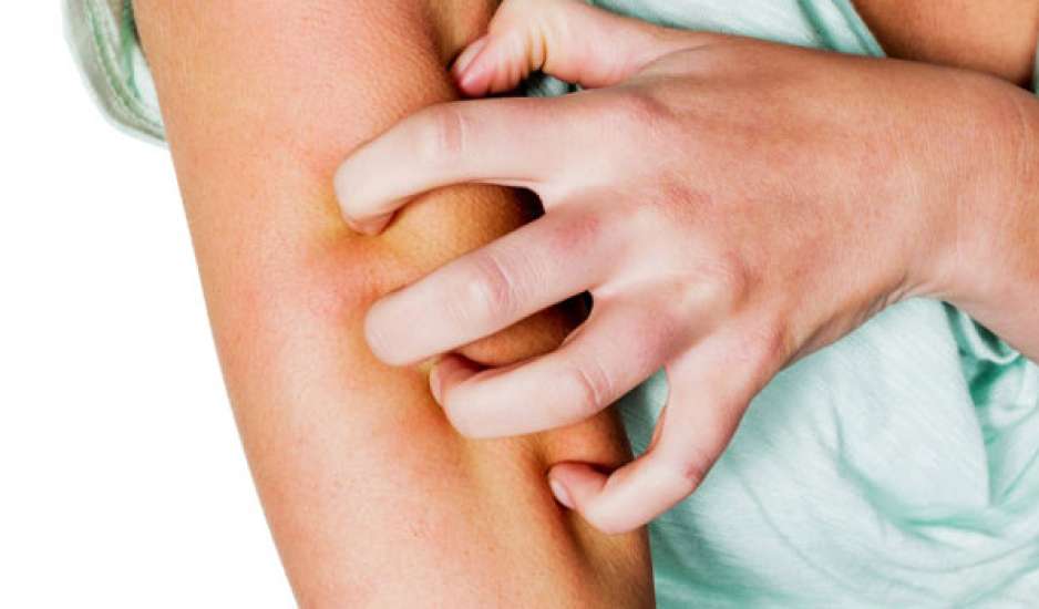 Οι 10 συνηθέστερες αιτίες της επίμονης φαγούρας στο δέρμα