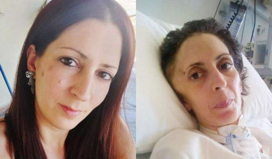 Κατέληξε η 41χρονη Όλγα που ξυλοκοπήθηκε βάναυσα από τον σύντροφό της - Θα υπάρξει αλλαγή στην ποινή του;