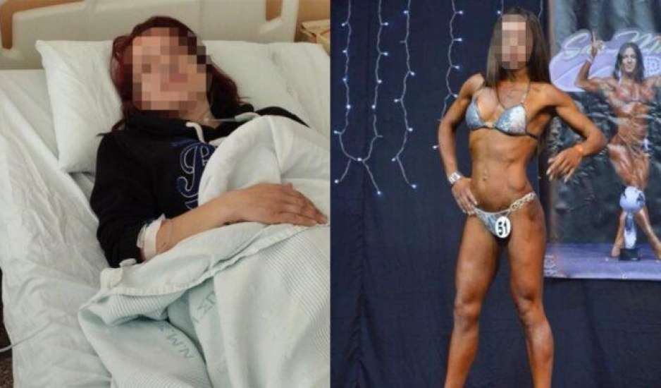 Σπάρτη: Πρώην bodybuilder έπεσε θύμα ξυλοδαρμού από τον σύζυγό της – Με χτυπούσε στο πάτωμα με μανία