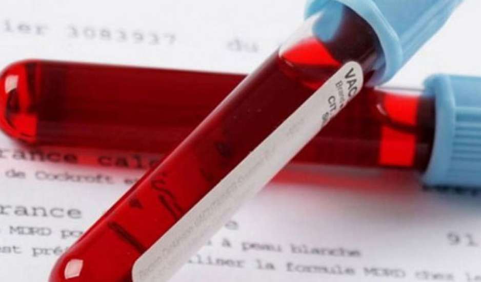 Θα κάνεις αιματολογικές εξετάσεις χοληστερίνης; Να τι μπορείς να φας το προηγούμενο βράδυ