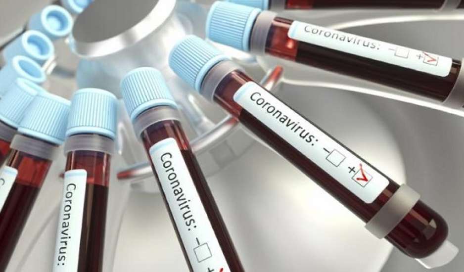 Κορονoϊός: Κρούσματα σε εταιρεία στην Κύπρο που κάνει τεστ για τον ιό