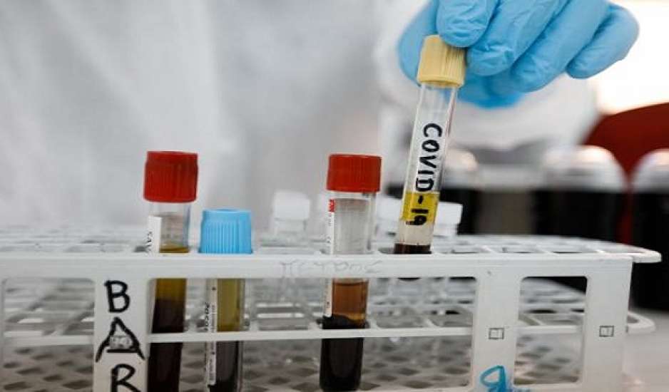 Κορονοϊός: Έμεινε στάσιμη η έρευνα για τον καρκίνο λόγω της πανδημίας