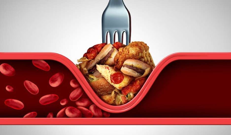Τι είναι η χοληστερόλη και πώς προκαλεί καρδιακή νόσο