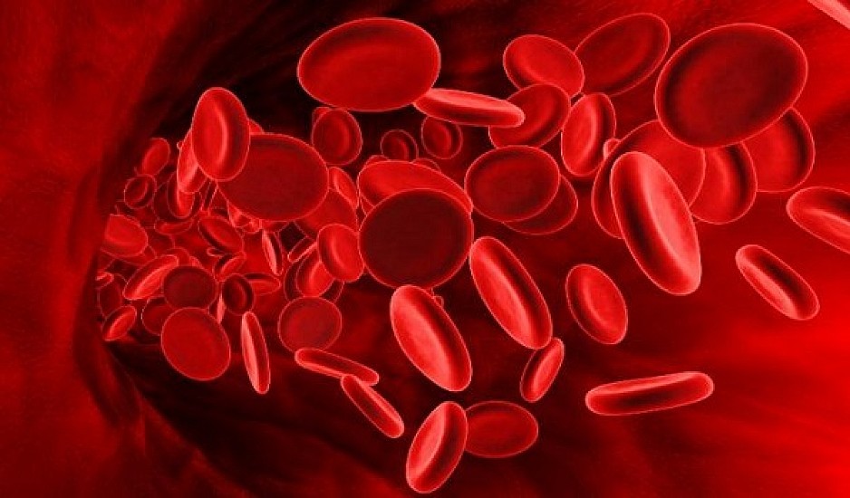 Επαναστατική θεραπεία μειώνει την ανάγκη για μεταγγίσεις αίματος