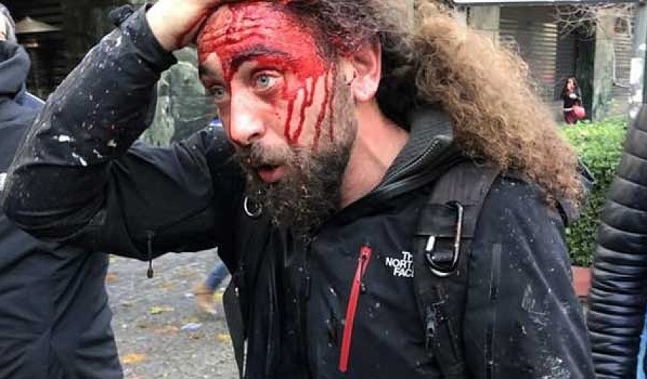 Καταγγελία για δολοφονική επίθεση διαδηλωτών εναντίων φωτορεπόρτερ