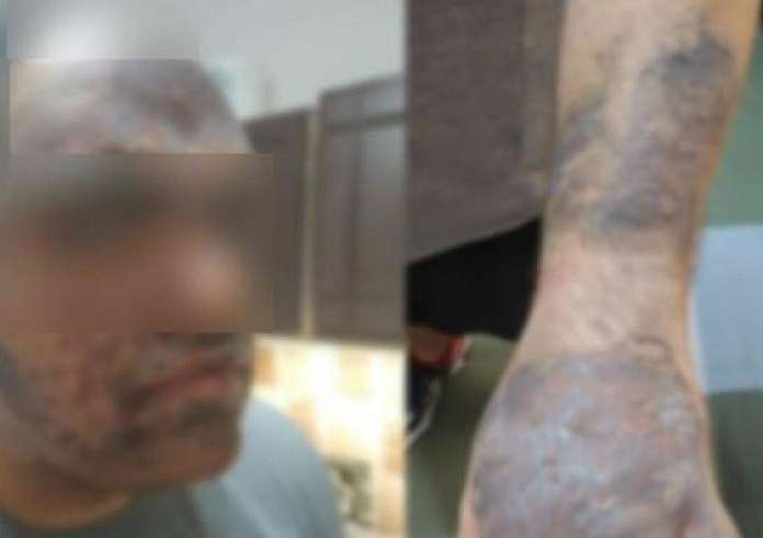 Ούρλιαζε, δεν άντεχε τους πόνους - Έτρεμε κυριολεκτικά