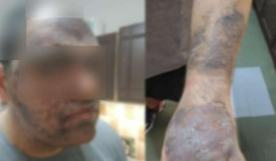 Ούρλιαζε, δεν άντεχε τους πόνους - Έτρεμε κυριολεκτικά