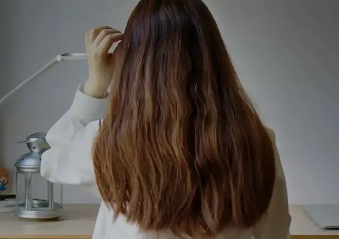 Θεσσαλονίκη: Η 14χρονη με σύνδρομο «Ραπουνζέλ» έτρωγε επί 12 χρόνια τρίχες από τα μαλλιά της